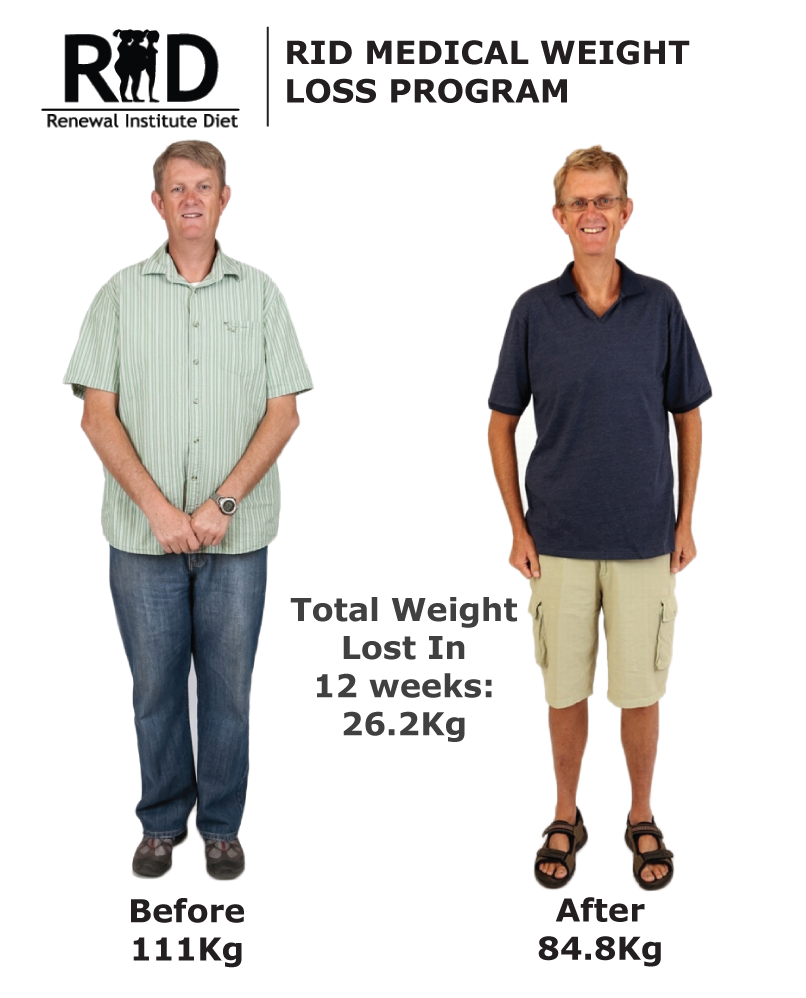 Rid Before And After Renewal Institute Diet Medical Hcg Weight Loss Male 25