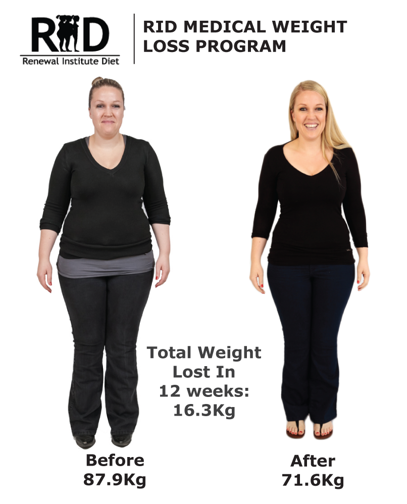 Rid Before And After Renewal Institute Diet Medical Hcg Weight Loss Female 29