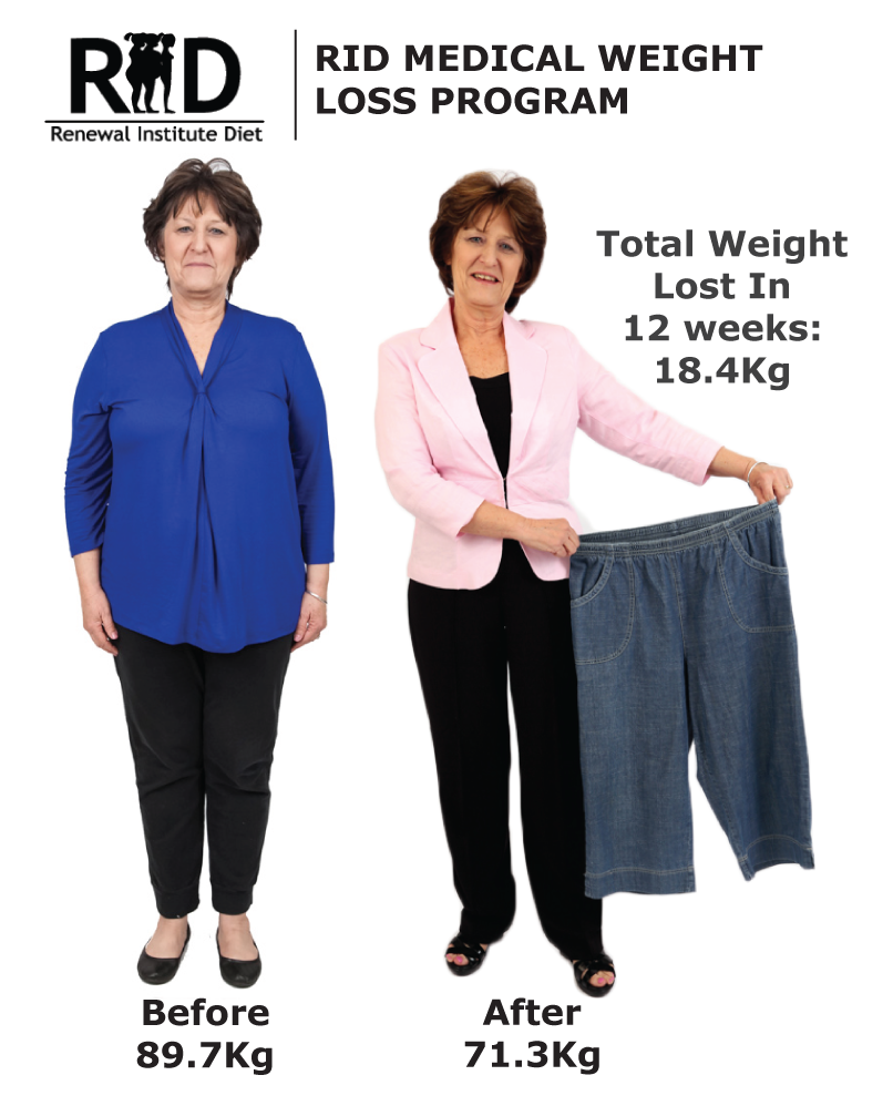 Rid Before And After Renewal Institute Diet Medical Hcg Weight Loss Female 31