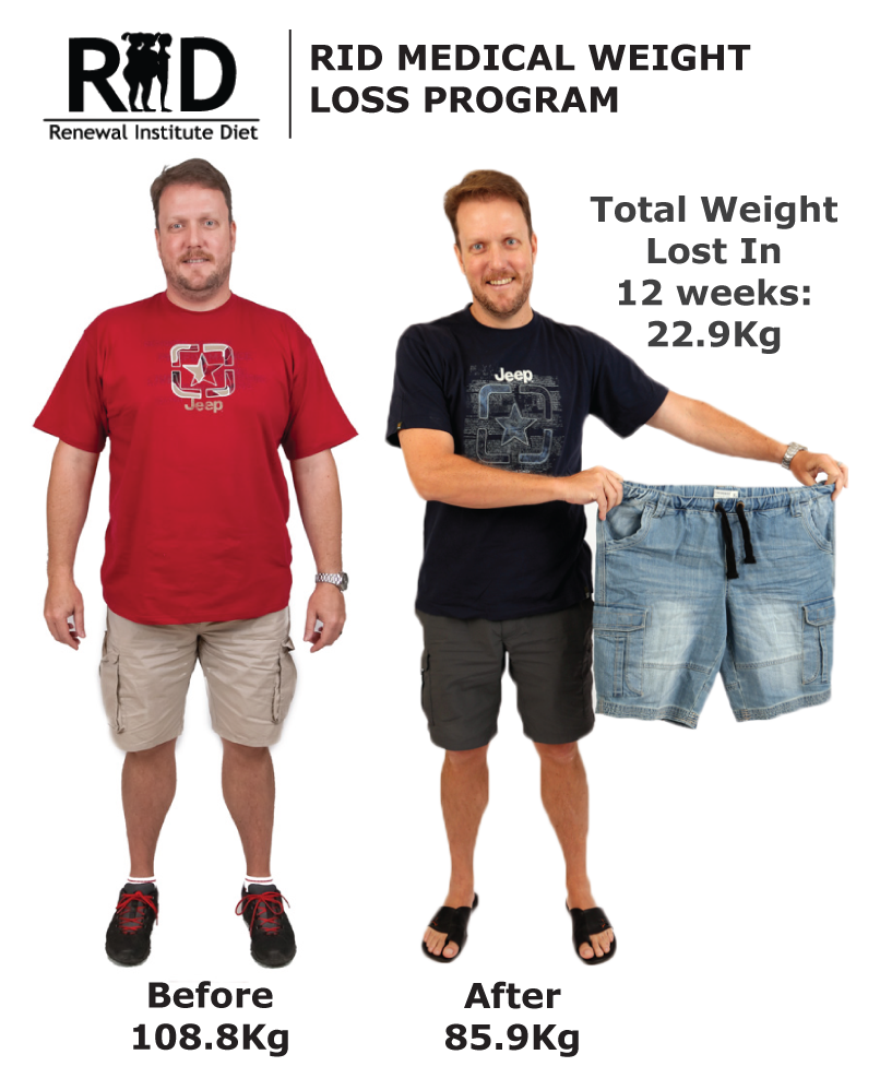 Rid Before And After Renewal Institute Diet Medical Hcg Weight Loss Male 24